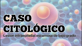 Lesión escamosa de bajo grado en citologia cervicovaginal [upl. by Tonneson]