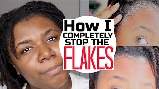 How To COMPLETELY Stop DryFlaky Scalp in 2023 UPDATED Scalp Routine  Starter Locs [upl. by Aydan646]