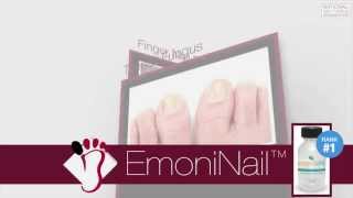 EmoniNail Toenail Fungus Treatment  Video Review [upl. by Golub]