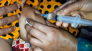 Ceftriaxone 500mg Trizon amp Dexamethasone injection im injection Video 24 Ep 25 By Injection Tips [upl. by Johppa]