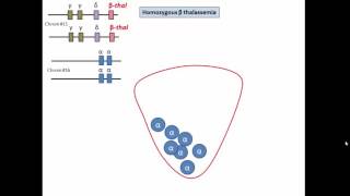 pathophysiology of beta thalassemia [upl. by Anaugal]