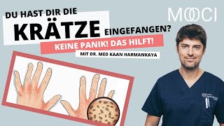 Krätze erkennen amp behandeln Das hilft gegen Milben [upl. by Okir848]