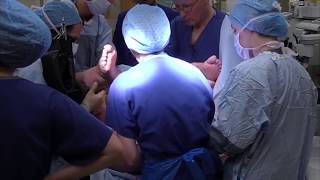 Having a forceps delivery  Understanding Shoulder Dystocia  One Born Every Minute [upl. by Anetsirk60]