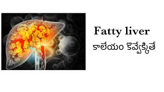 All about Fatty Liver in TeluguNAFLDliver fibrosis cirrhosis fattyliver [upl. by Gilcrest]