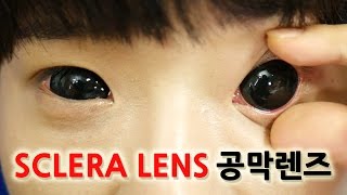 임팩트 오지는 공막렌즈 후기SCLERA lens렌즈 끼기 빼기렌즈미도쿄구울 렌즈레이킴 뷰티외과 [upl. by Kass]