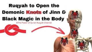 Very Powerful Ruqyah to Open the Demonic Knots of Jinn amp Blackmagic in the Body amp Disease caused [upl. by Garlan]