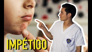 IMPÉTIGO Infección bacteriana en niños👶👦👧 [upl. by Yrkcaz]