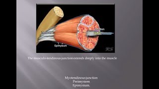 MYOPATHY by MRI DR EMAN FAHIM [upl. by Aitnas]