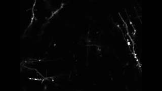 Dendrites and dendritic spines in the mouse cortex [upl. by Noorah]