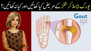 How To Cure Uric Acid Crystals Naturally  Gout Ka Ilaj at Home [upl. by Nnave]