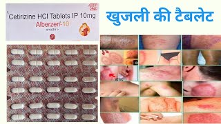 cetirizine tablet use in hindi  खुजली की सबसे अच्छी टैबलेट गारंटी से आराम मात्र दो दिन में [upl. by Kakalina]