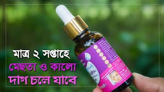 ২ সপ্তাহে মেছতার দাগ দূর করার সিরাম  মেছতা দূর করার ক্রিম Melasma Breakdown Serum [upl. by Iinde]