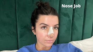 I got nose surgery  ellie zeiler [upl. by Picco]