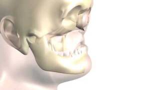 NearTotal Face Transplant Surgical Animation [upl. by Leland]