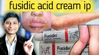 Fucidin Cream  Fusidic Acid CreamOintment  हिंदी में Uses Side Effects  Fusiwal Cream [upl. by Furlong]