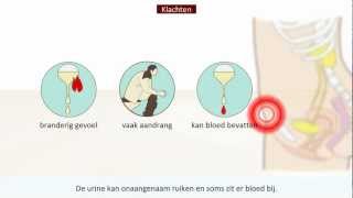 Blaasontsteking  Oorzaak en behandeling [upl. by Alleris]