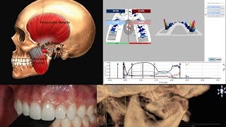 TMJ Pain Addressed 85 of the Time THE Definitive TMD amp DTR Documentary [upl. by Leith]