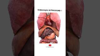 Endoscopic Ultrasound procedure  Short Animated Video [upl. by Gilroy]