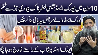 Uric Acid Treatment  Uric Acid Ka ilaj  Uric Acid Ki Alamat  Uric Acid Ka Parhez Dr Sharafat Ali [upl. by Nylaehs]