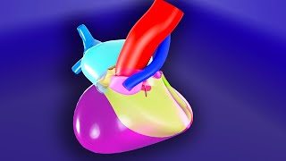 Tetralogy of Fallot  3D Animated Visual Lecture [upl. by Jacobs]