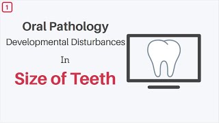 Developmental Disturbances in Size of Teeth Oral Pathology [upl. by Isia]