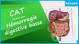 Inquiétant comment gérer une Hémorragie digestive basse 🤔  📝La CAT Résumé est là 😄  HGElogie [upl. by Niret]