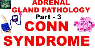 Adrenal Gland Pathology Part 3 HYPERALDOSTERONISM CONN SYNDROME [upl. by Jamey]