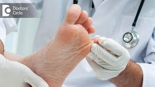 Diagnosis and prevention of Diabetic foot  Dr Mohan M R [upl. by Najed]