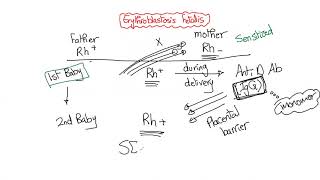 Erythroblastosis fetalis I One Concept I Rh positive baby amp Rh negative mother  What may happen [upl. by Atikaj]