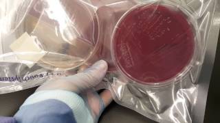 Microbiology Propionibacterium acnes anaerobic set up and colonial growth [upl. by Akelam482]