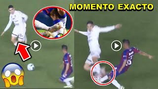 Video completo Lesión de Hobbit Bermúdez Atlante vs Dorados ESTO PASO momento exacto Hobbit Bermúdez [upl. by Benedikta618]