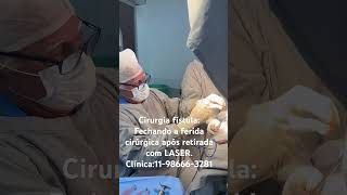 Dr Paulo Branco fazendo cirurgia fissura c 37 anos de experiência a Laser c anestesia local [upl. by Osher]