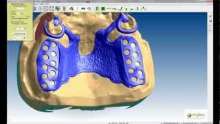 Logiciel CAO DIGISTELL pour la création de châssis squeletté pour prothésistes dentaires Part 2 [upl. by Adara]
