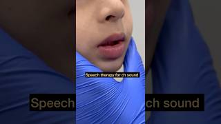 Speech Therapy  Articulation ch Sound  Tongue Positioning  Mis articulation  Teach Sound [upl. by Lukin780]