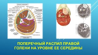 ПОПЕРЕЧНЫЙ РАСПИЛ ГОЛЕНИ НА УРОВНЕ ЕЕ СЕРЕДИНЫ [upl. by Siocnarf34]