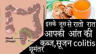 इसके जूस से रातो रात आपकी आंत की कब्ज़सूजनulcers colitis हो जायेगे छूमंतर [upl. by Bourke]