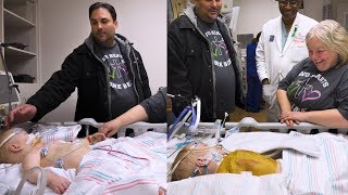 Mom Overcome with Emotion Seeing Conjoined Babies Apart After 7Hour Surgery [upl. by Jamal335]