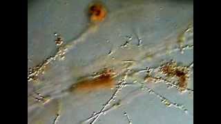 Bacteria Fungi Protozoa and Nematodes from soil [upl. by Angelo563]