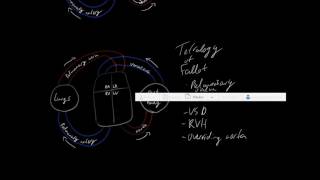 Tetralogy of Fallot Nursing NCLEX  Congenital Heart Disease Defects [upl. by Child]