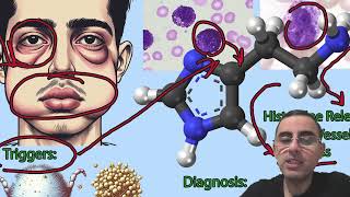 Understanding Hives Urticaria Symptoms Causes and Treatments [upl. by Yesiad377]