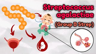 Streptococcus agalactiae A Detailed Look at Physiology Virulence Factors amp Clinical Significance [upl. by Yddub532]