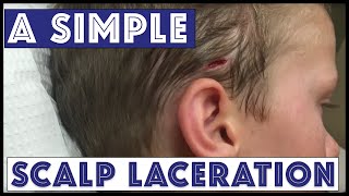 A Sunday Scalp Laceration [upl. by Gianni]