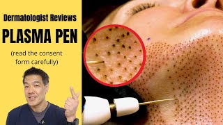 How to Remove Skin Tags around Neck with Electric Cautery  Skin Tag Removal Procedure [upl. by Atoel]