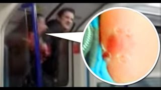 WOMAN BITES MAN S ARM IN LONDON DISGUSTING [upl. by Anilef866]