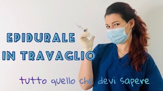 EPIDURALE IN TRAVAGLIO E PARTO  Tutti i pro e contro della partoanalgesia [upl. by Filler391]