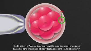 RI Saturn 5™ Active laser [upl. by Papst523]