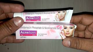 Acnetoin Gel review चेहरे के दाग़ धब्बे एक्ने पिम्पल्स को कैसे रोके [upl. by Maller]