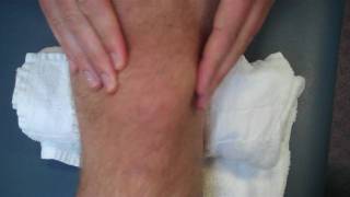 physical therapy guru patellar mobilizations [upl. by Nihi996]