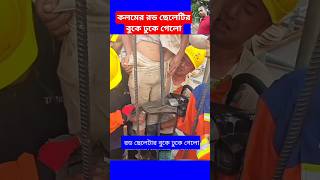 কলমের রড ছেলেটির বুকে ঢুকে গেলোconcrete construction working plan work shorts viral trending [upl. by Ydnirb]