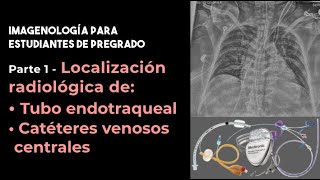 Parte 1 Localización radiológica del tubo endotraqueal y catéteres venosos centrales [upl. by Havens]